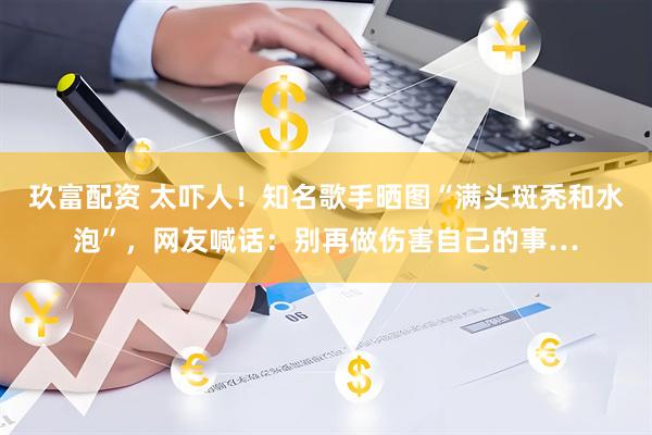 玖富配资 太吓人！知名歌手晒图“满头斑秃和水泡”，网友喊话：别再做伤害自己的事…